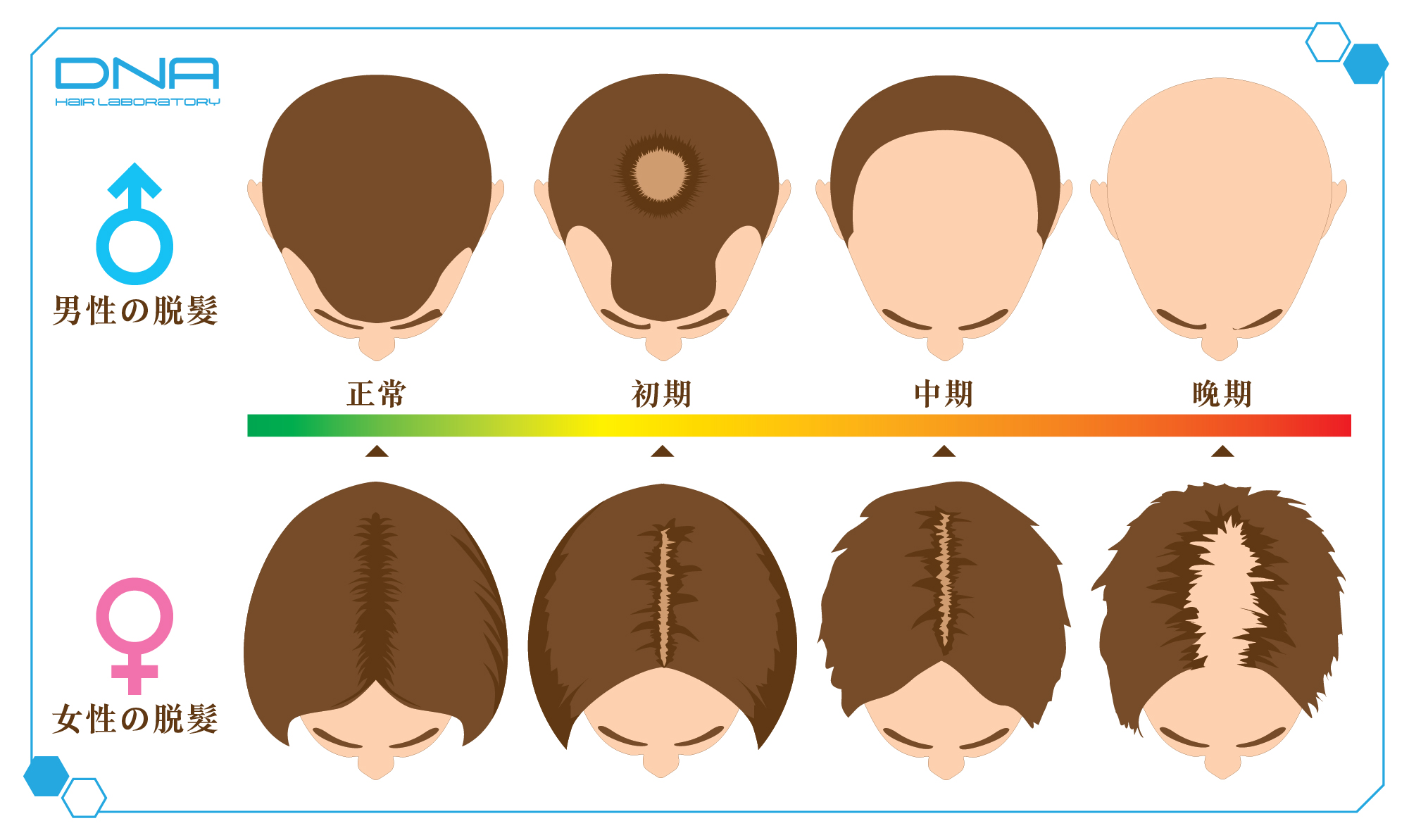 為什麼女性會有雄性禿？